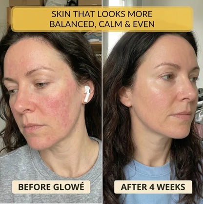 Glow Activating Lift Serum | The Peptide Serum That Rebuilds Skin Structure for Firmness That Actually Holds