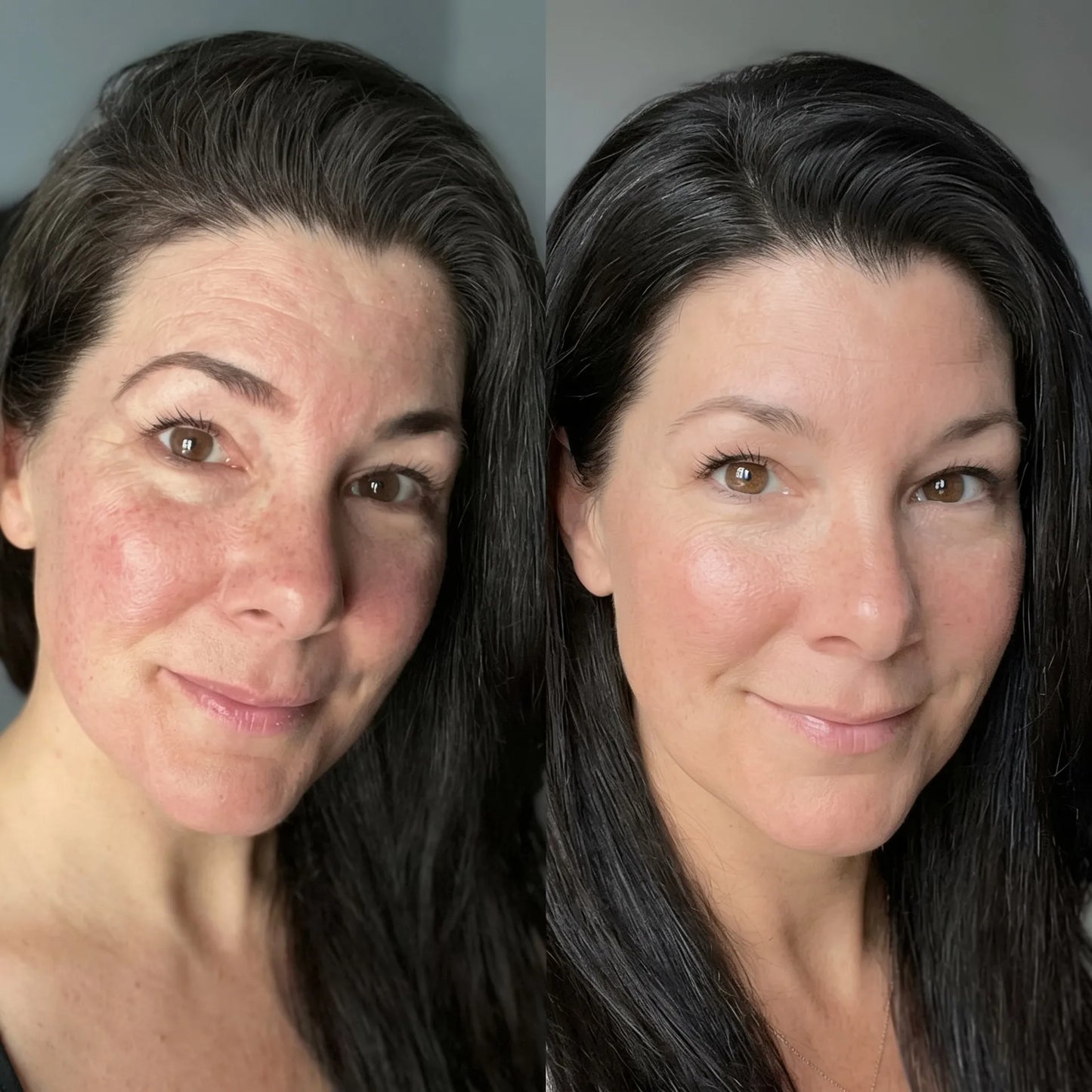 Bakuchiol Renewal Oil - Visibly firmer, smoother skin in weeks. No peeling, no redness, no purge.