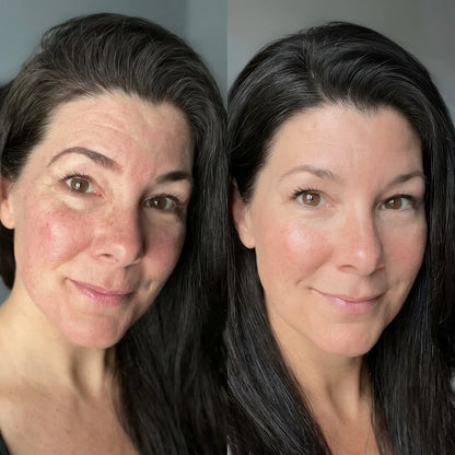 Bakuchiol Renewal Oil - Visibly firmer, smoother skin in weeks. No peeling, no redness, no purge.