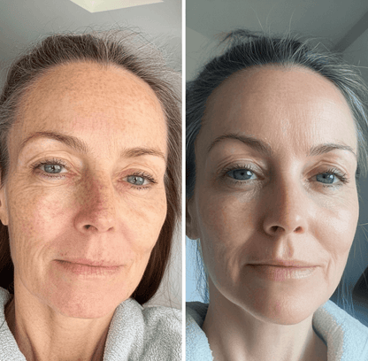 Return To Radiance Cleansing Milk - Cleanse Without Stripping Your Skin