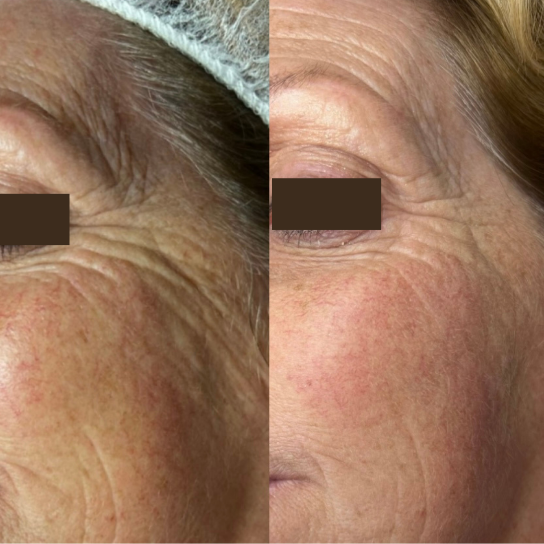 Inner Glow Collagen Cream – Comforting Daily Support for Skin That Needs Extra Care