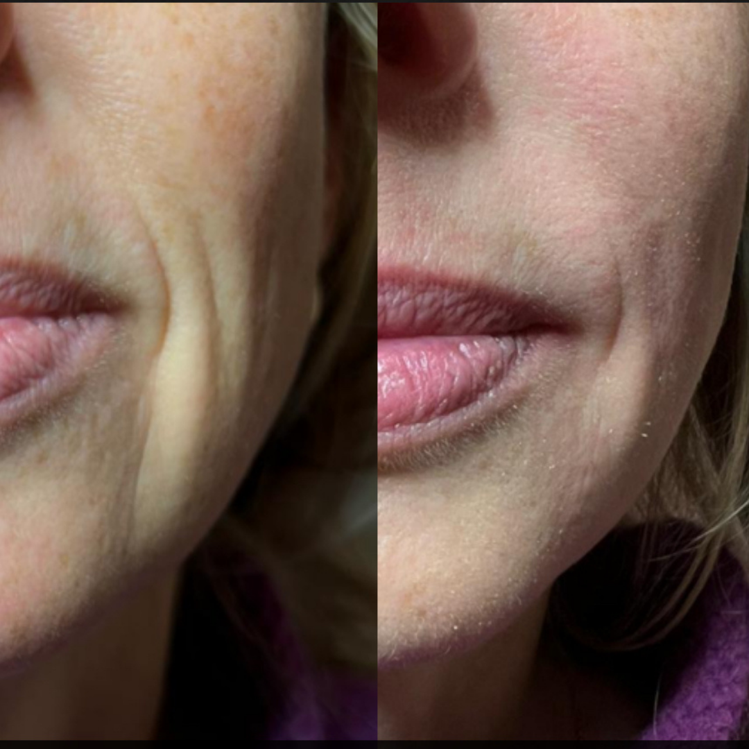 Inner Glow Collagen Cream – Comforting Daily Support for Skin That Needs Extra Care