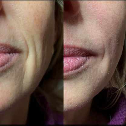 Inner Glow Collagen Cream – Comforting Daily Support for Skin That Needs Extra Care